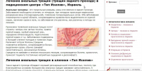 Анальные трещины