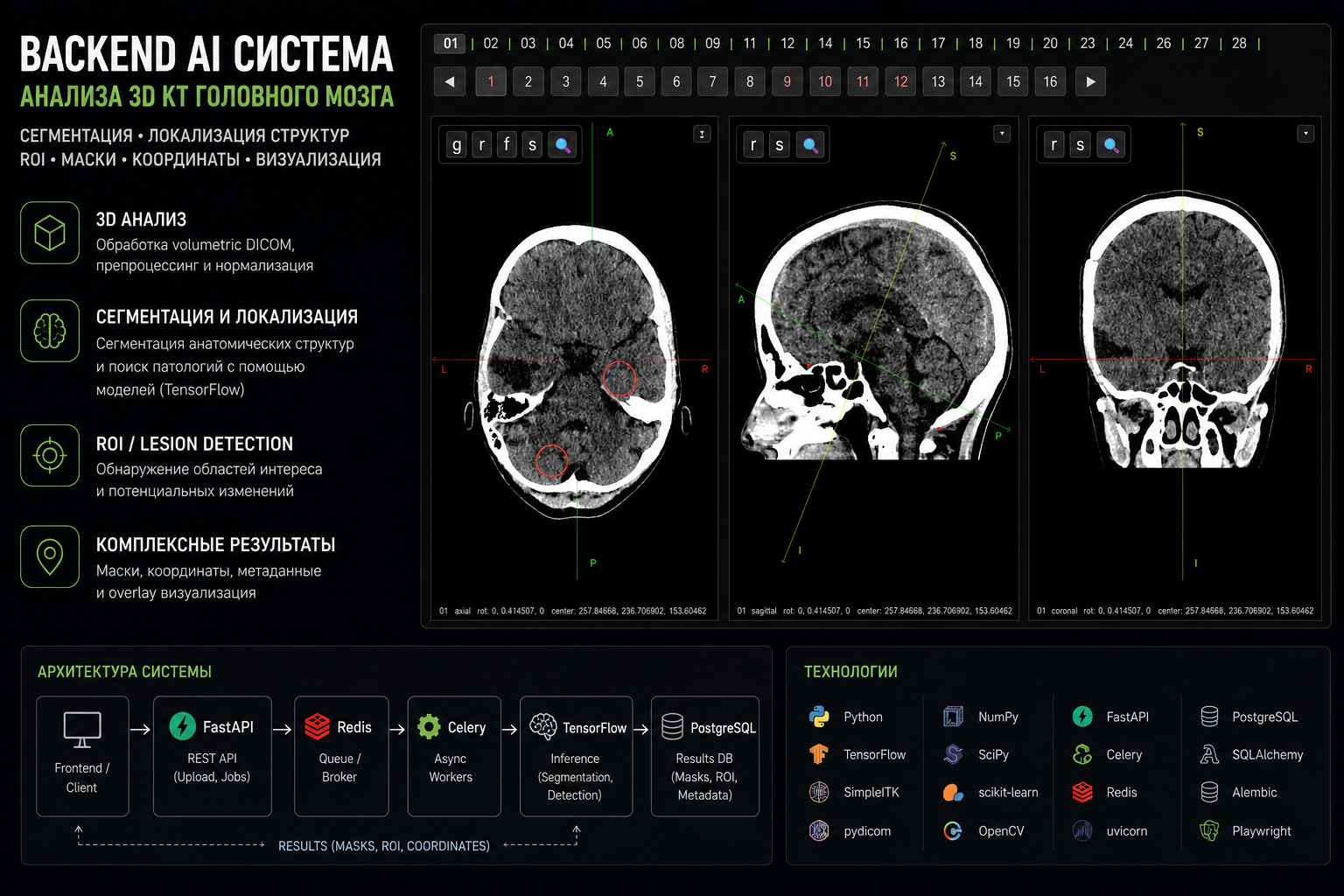 AI/CV система для анализа 3D КТ головного мозга