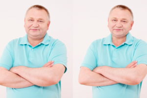 пластика